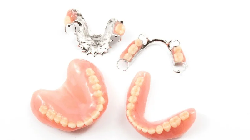 Alternative Tooth Replacement Options