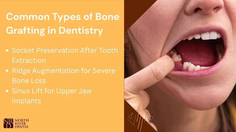 Types of Bone Grafting Procedures