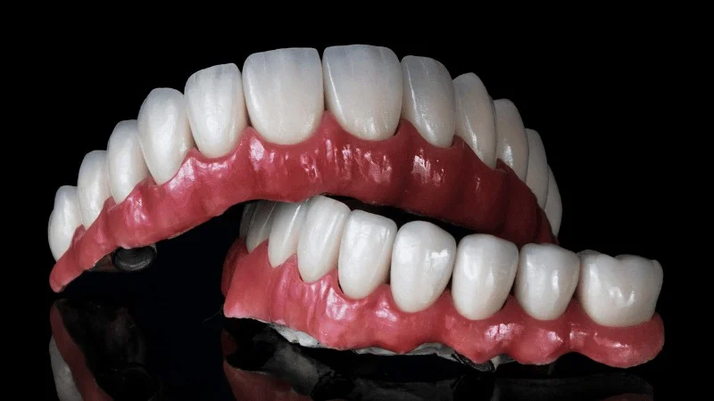 are hybrid dental implants worth it