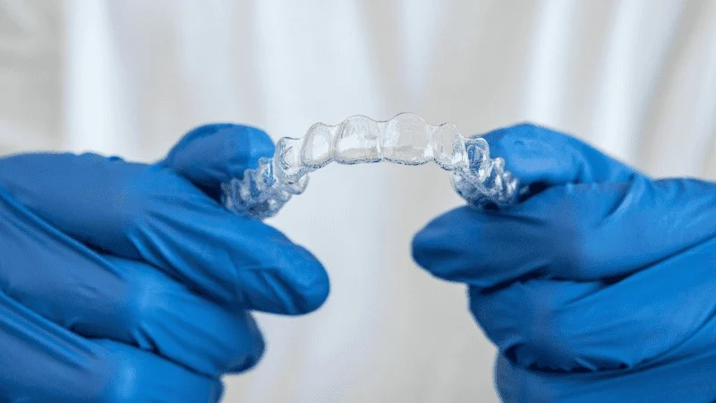 clear aligners treatment timeline