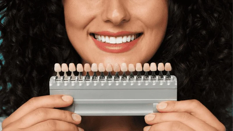 veneers vs teeth whitening