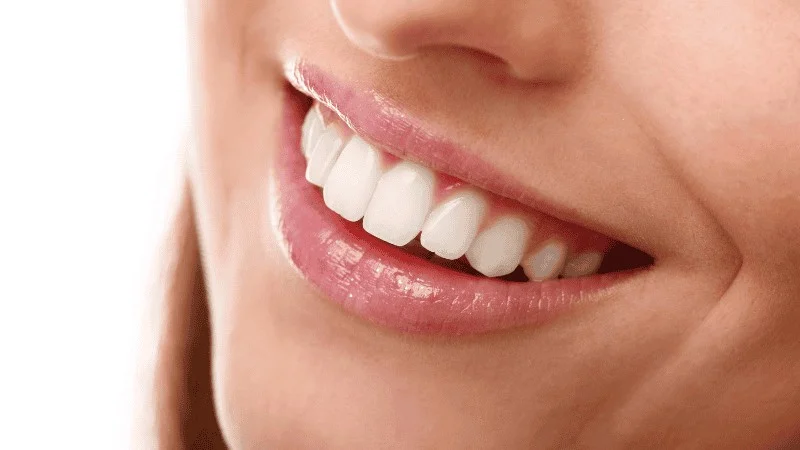 how to maintain teeth whitening results